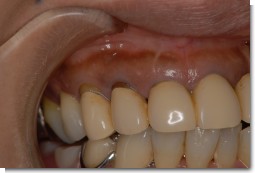 森岡 レーザー前.JPG 森岡 レーザー前.JPG